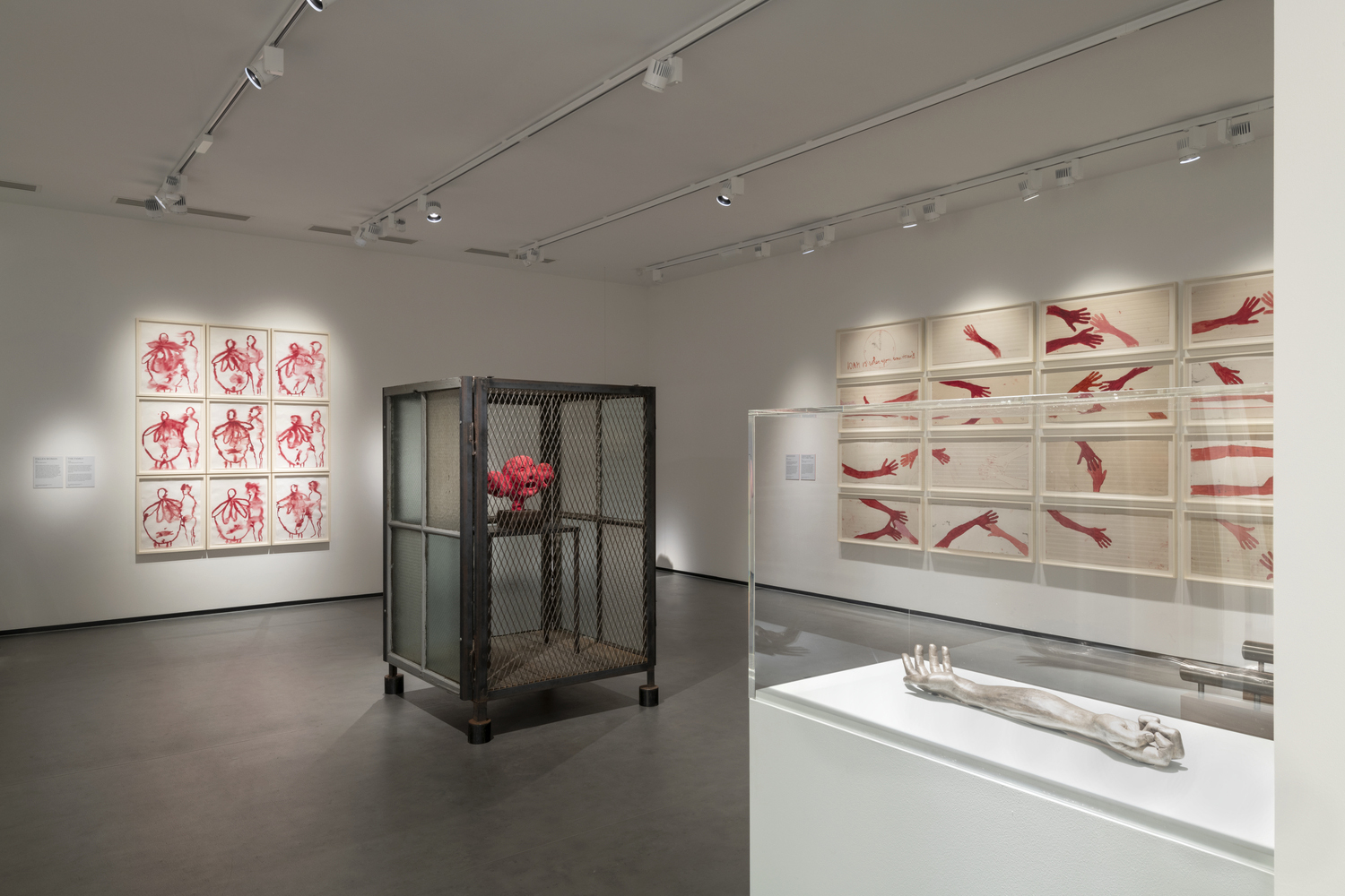 Louise Bourgeois, Dorset Artist Rooms